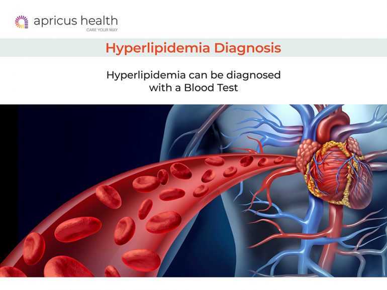 Hyperlipidemia Or High Cholesterol Causes Diagnosis And Treatment Apricus Health 7526